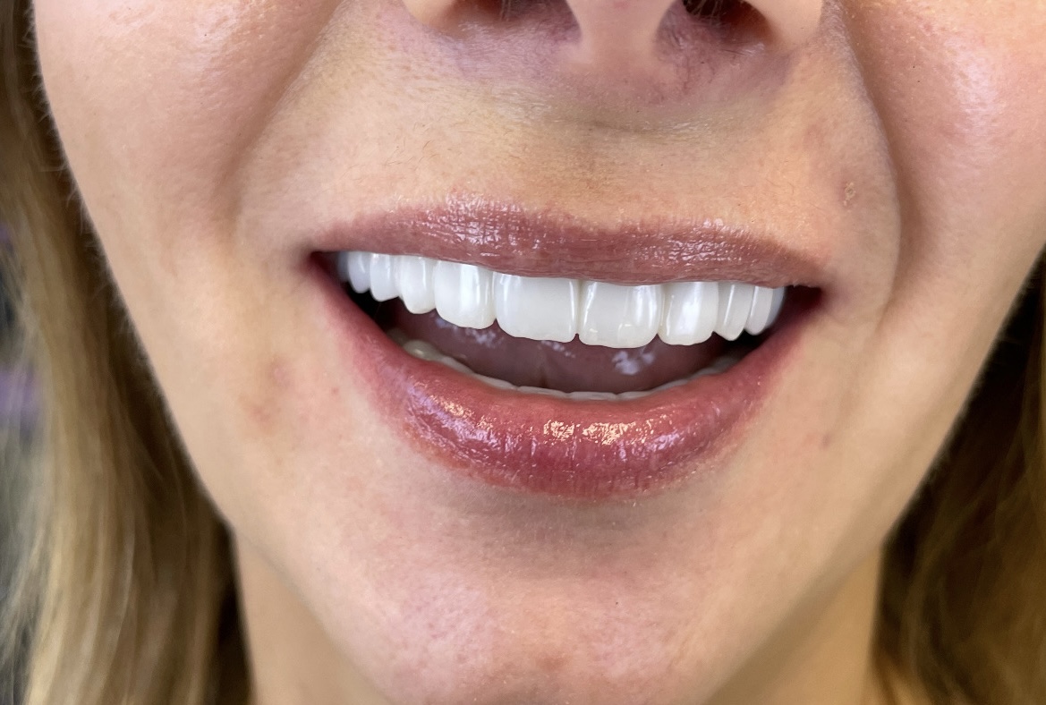 Po leczeniu - Prawda, że jest już pięknie?