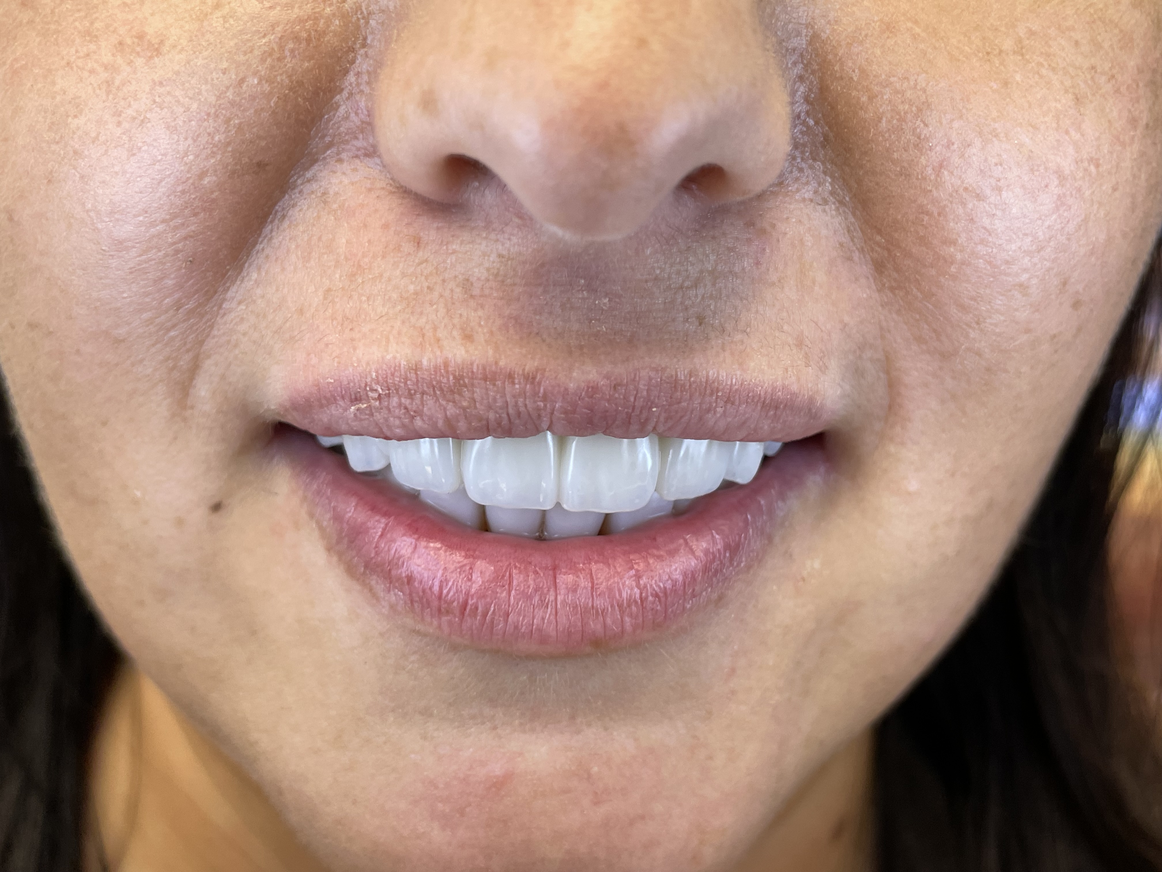 Po leczeniu - Nowy uśmiech, nowe życie